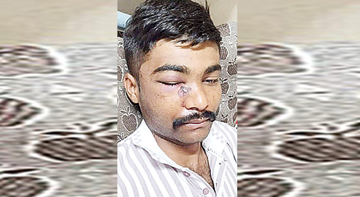 Aajkaal Daily (Desh Pardesh Ni Aajkaal)