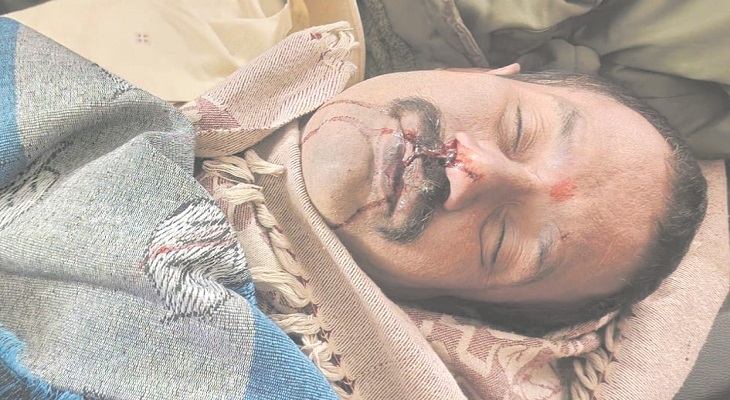 Aajkaal Daily (Desh Pardesh Ni Aajkaal)